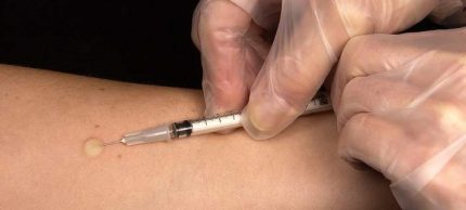 vaccination-708